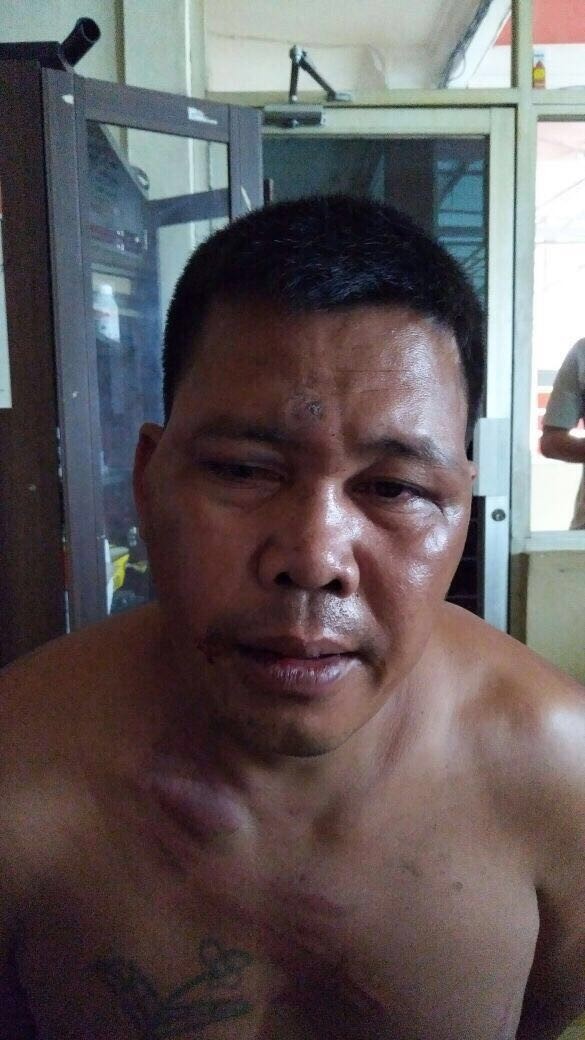 Pencuri Truk di Batanghari yang Ditembak Polisi di Bungo.